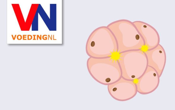 Congres VoedingNL 2021: Vetten en metabole gezondheid